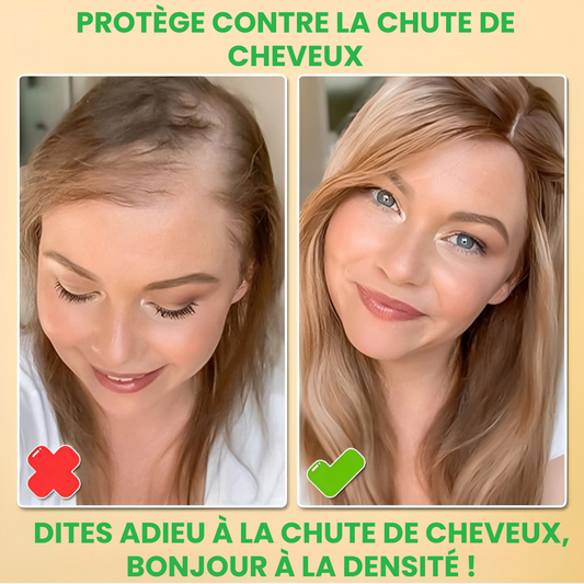 BIOTIN® – Stimulez la Repousse en 2 Minutes – Sérum Capillaire Rapide et Efficace – Économisez Temps et Argent