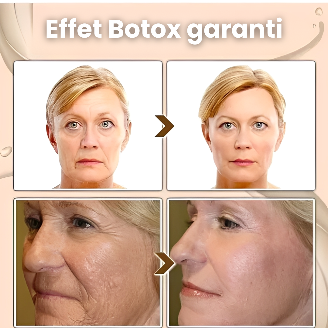 QINGLING® – Effacez Rides et Ridules et Illuminez Votre Peau en 14 Jours – Le Soin Anti-Âge Qui Fait Paraître 10 Ans de Moins