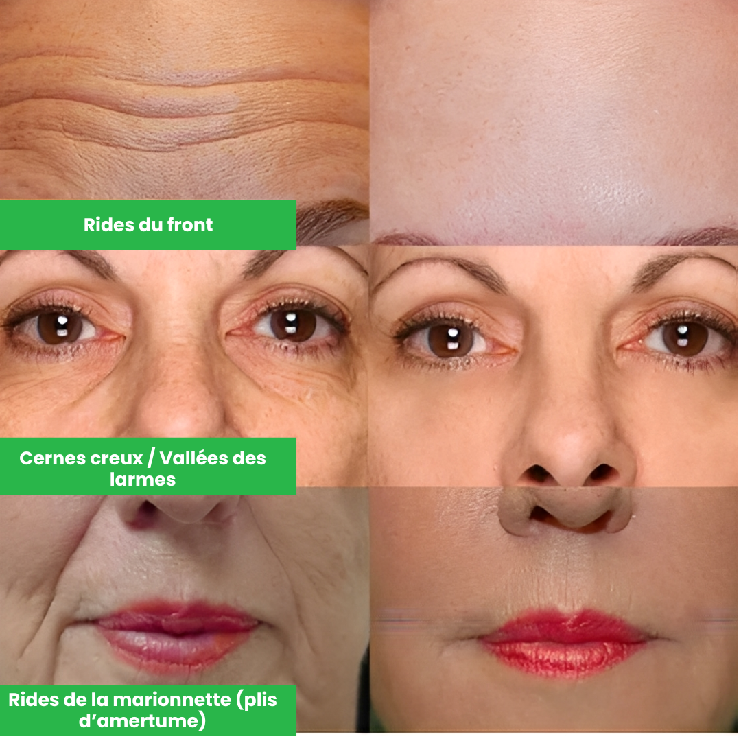 QINGLING® – Effacez Rides et Ridules et Illuminez Votre Peau en 14 Jours – Le Soin Anti-Âge Qui Fait Paraître 10 Ans de Moins