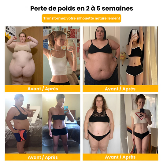 SCULPTRA® – Une Silhouette Affinée et Galbée en 7 Secondes – Sans Sport, Sans Régime, Sans Inconfort