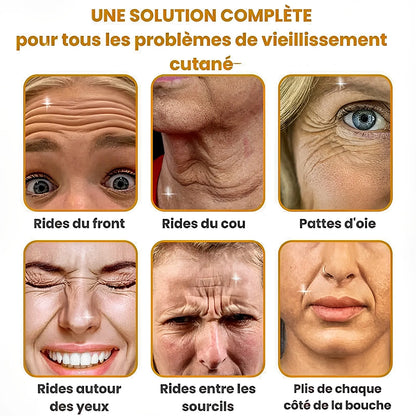 BOTOX™ – Gagnez 10 Ans en 2 minutes – Sans Injection, Sans Chirurgie, Sans Ruiner Votre Portefeuille