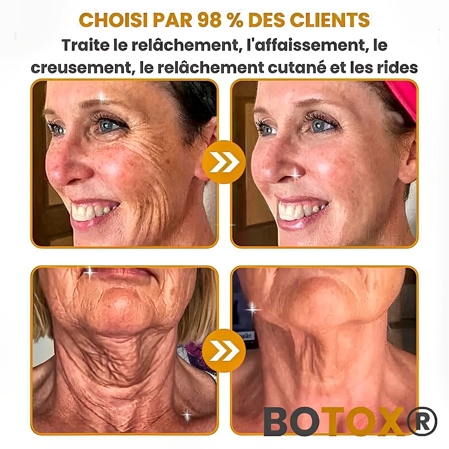 BOTOX™ – Gagnez 10 Ans en 2 minutes – Sans Injection, Sans Chirurgie, Sans Ruiner Votre Portefeuille