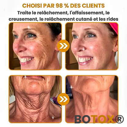 BOTOX™ – Gagnez 10 Ans en 2 minutes – Sans Injection, Sans Chirurgie, Sans Ruiner Votre Portefeuille