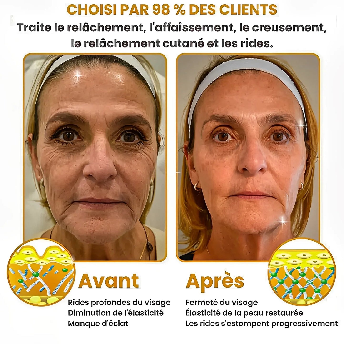 BOTOX™ – Gagnez 10 Ans en 2 minutes – Sans Injection, Sans Chirurgie, Sans Ruiner Votre Portefeuille