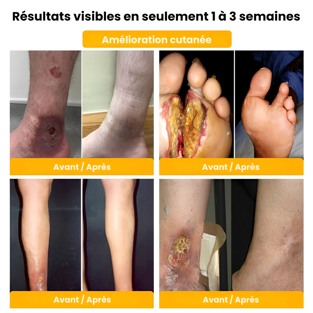 SCULPTRA® – Une Silhouette Affinée et Galbée en 7 Secondes – Sans Sport, Sans Régime, Sans Inconfort