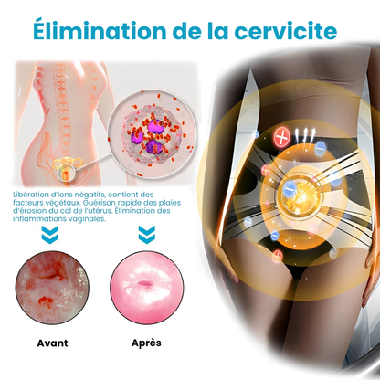 SCULPTRA® – Une Silhouette Affinée et Galbée en 7 Secondes – Sans Sport, Sans Régime, Sans Inconfort