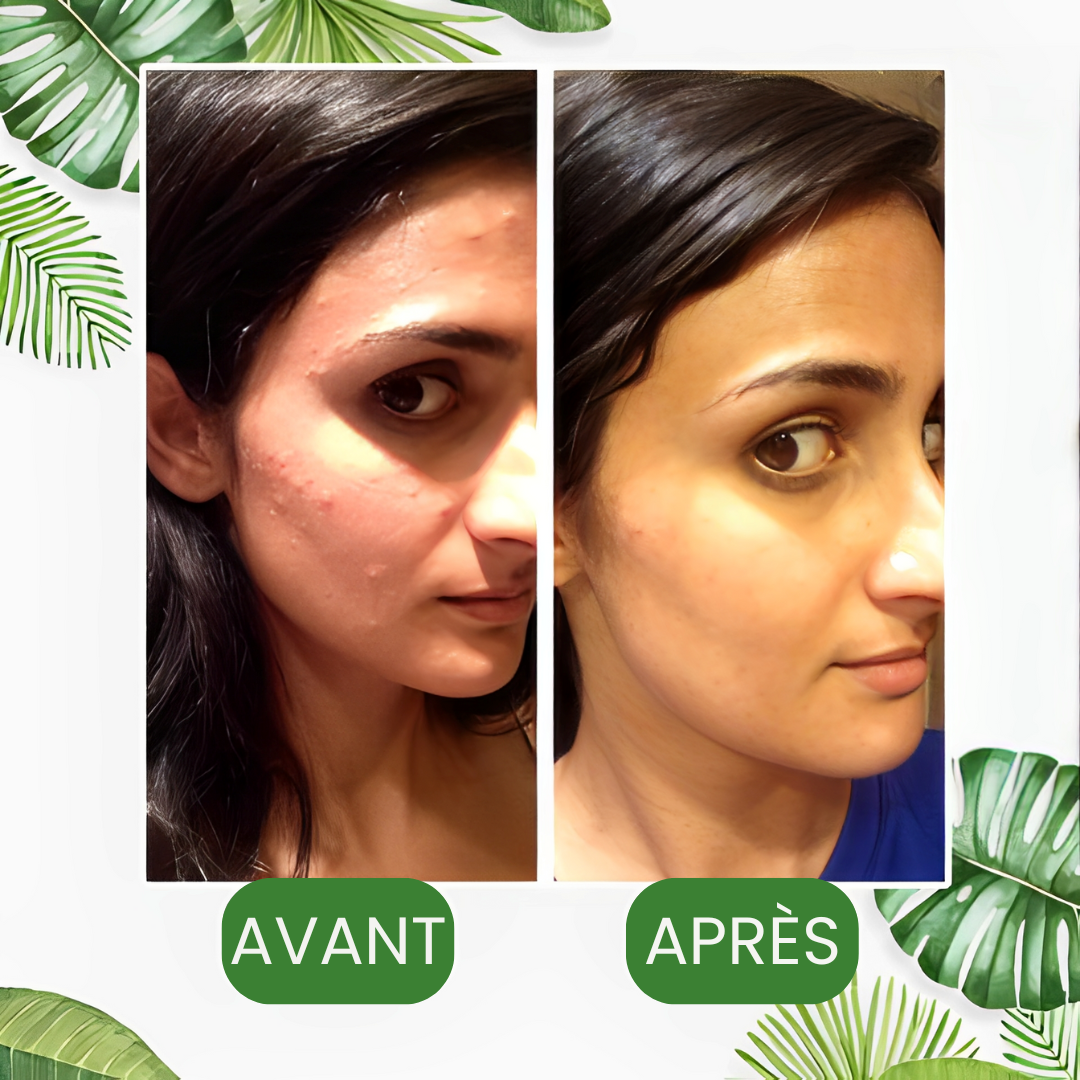 MASK® – Le Stick Nettoyant qui Élimine les Points Noirs en 10 Minutes