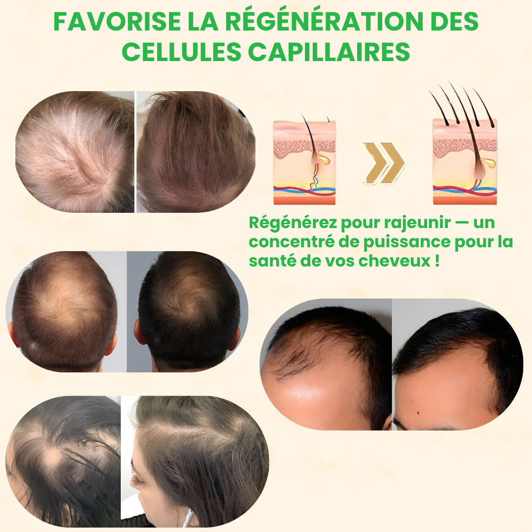 BIOTIN® – Stimulez la Repousse en 2 Minutes – Sérum Capillaire Rapide et Efficace – Économisez Temps et Argent