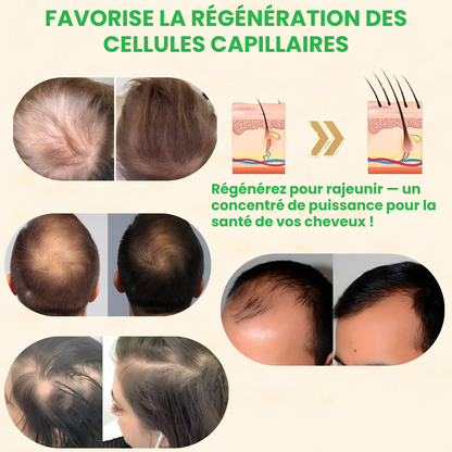 BIOTIN® – Stimulez la Repousse en 2 Minutes – Sérum Capillaire Rapide et Efficace – Économisez Temps et Argent