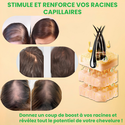 BIOTIN® – Stimulez la Repousse en 2 Minutes – Sérum Capillaire Rapide et Efficace – Économisez Temps et Argent