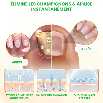 TIMILK® – Éliminez la Mycose en 7 Jours – Spray Réparateur d’Ongles Rapide et Efficace – Retrouvez Confiance et Beauté Naturelle