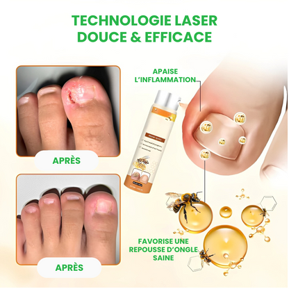 TIMILK® – Éliminez la Mycose en 7 Jours – Spray Réparateur d’Ongles Rapide et Efficace – Retrouvez Confiance et Beauté Naturelle