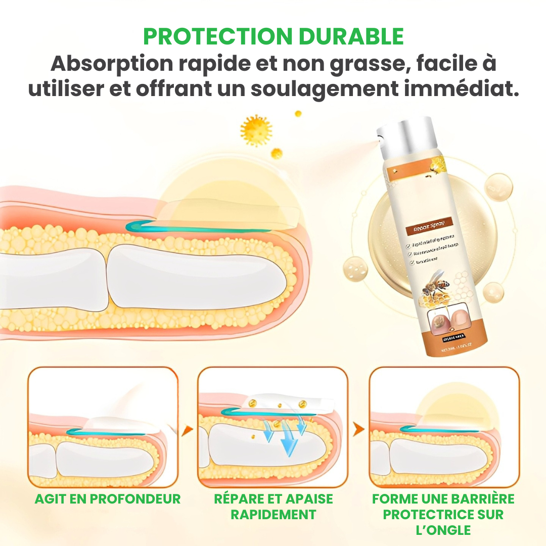 TIMILK® – Éliminez la Mycose en 7 Jours – Spray Réparateur d’Ongles Rapide et Efficace – Retrouvez Confiance et Beauté Naturelle